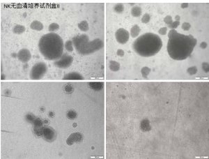 使用Corning? NK細(xì)胞無(wú)血清培養(yǎng)試劑盒II 高效地激活和擴(kuò)增人類自然殺傷細(xì)胞 應(yīng)