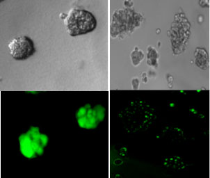 PLOS ONE:細(xì)菌的“通訊系統(tǒng)”可用于阻止或殺死癌細(xì)胞